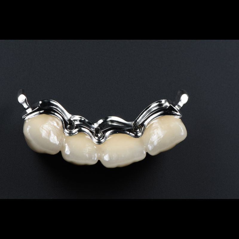 Precision Zirconia PFM Crowns Partial Dentures Natural Looking