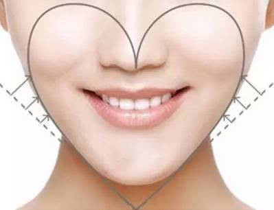 Sterile Injectable Dermal Filler Hydraulic Acid Injections For Face Fill Up Cheek
