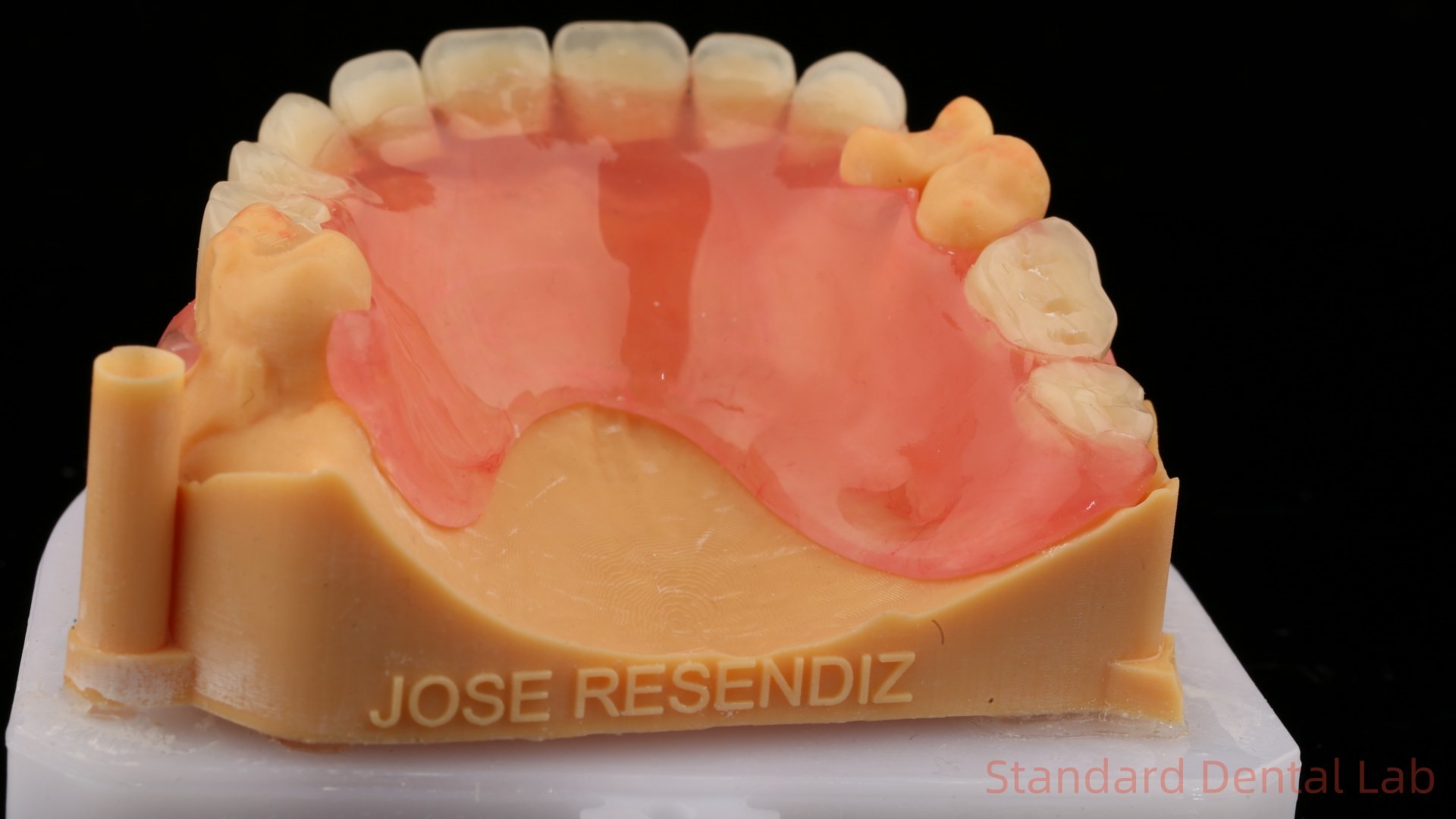 3D Print Model Dental TCS Valplast Flexible Partial Dentures Pink / Dark Color Dental Lab Product