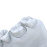 3d Dental Resin High Hardness Repair Type Model Resin