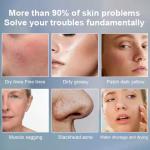 NIR Milk Light Whitening Beauty Equipment 3 Wavelength 755 808 1064 Permanent