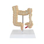 Advanced Medical Human Large Intestine Anatomy Model For School Hospital