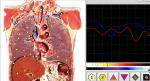 Body Analyzer Metatron NlS Hunter Version