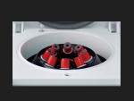 TD4D 5ml 10ml 15ml 20ml Low Speed PRP Centrifuge 4000rpm