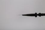 Professional 30MHZ laser treatment for broken capillaries spider vein removal
