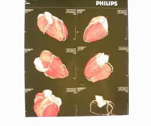 Quality Thin Konida X Ray Diagnostic Imaging Laser Blue Paper For Xray Machine wholesale