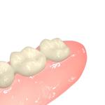 High Strength Invisible Denture Base Resin