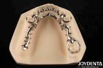 Alloying Metal Materials Dental Framework Suppleness for Oral Health Practitione