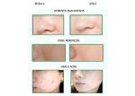Private Label Natural Dead Sea Mud Face Mask For Oily Skin Blackheads