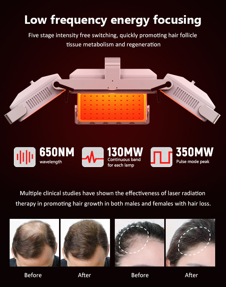 650nm 6 In 1 Laser Hair Growth Device For Scalp Care / Hair Regeneration
