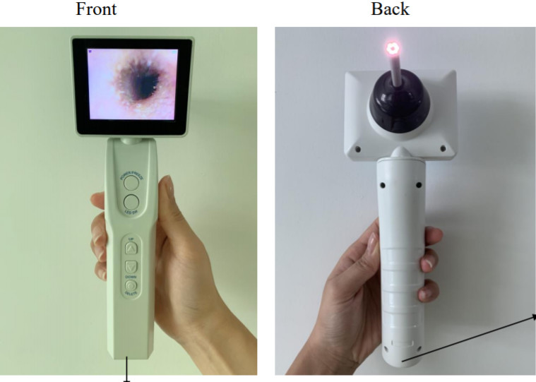 Handheld 3'' LCD Monitor Visual Inspection Otoscope Ear Equipment