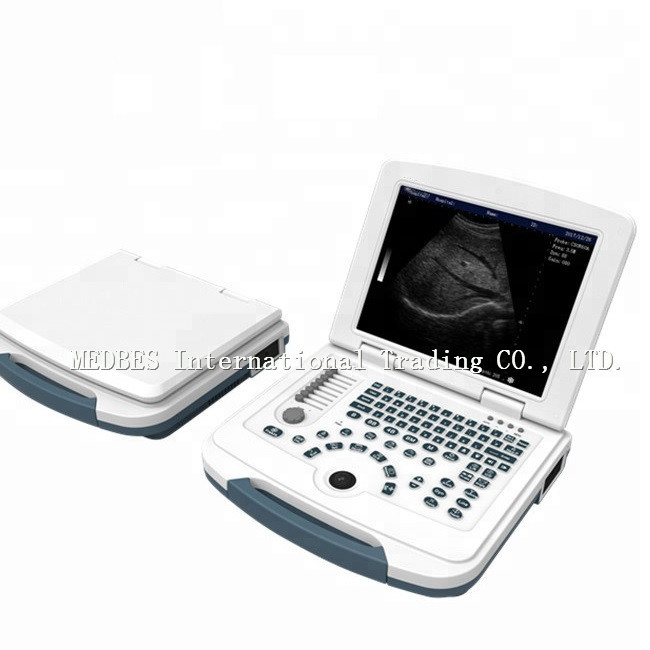 Portable 3D Black White Ultrasound Scanner Machine with Great Price