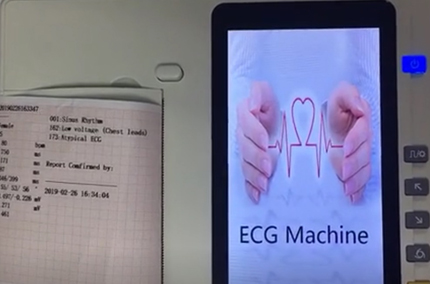 High resolution digital 12 channel portable ECG machine with LCD display