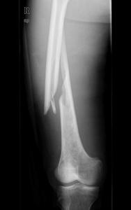 Quality Konida Laser X Ray Medical Imaging wholesale