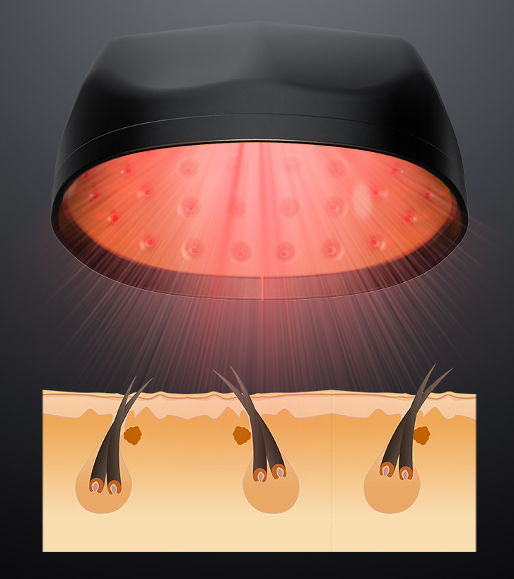 5mw/Pcs Medical Laser Hair Growth Caps LLLT Led Hair Growth Helmet