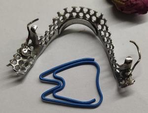 China Casted Mandibular Arch Partial Denture Metal Framework on sale