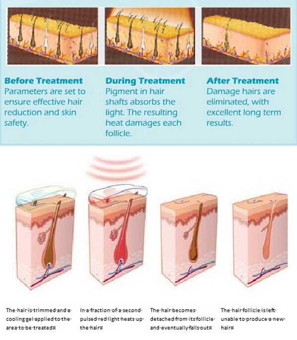 professional ipl beauty supply with CE approval for hair removal, pigment removal, wrinkle removal
