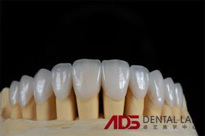 Quality Feldspathic Porcelain Laminate Dental Veneer Seamless Customized wholesale