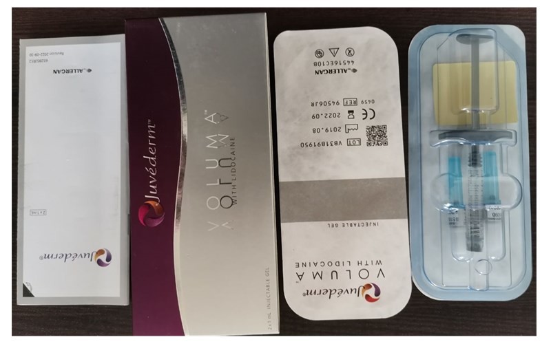 Chin Cheek Injection Cross Linked Juvederm Voluma Dermal Filler