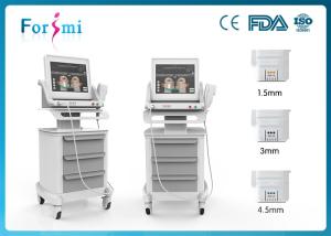 Quality High Intensity Focused on Ultrasound wrinkle removal machine with 300W input power wholesale