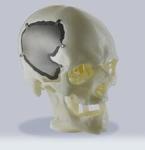 Professional SLS 3D Printing Service Customized Plastic Parts For Medical