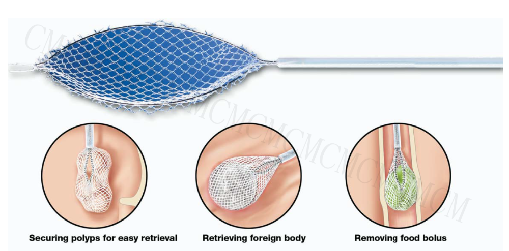 Stainless steel Endoscopy Accessory