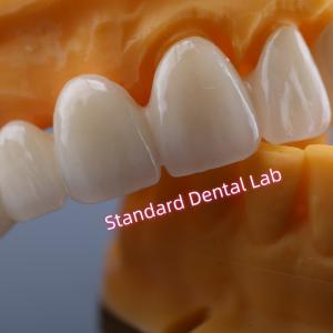Quality CAD CAM Mill Zirconia Crown Bridge Highly Biocompatible wholesale