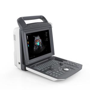 Quality Portable Full Digital Color Doppler Ultrasound System Medical Scanner Ultrasound wholesale