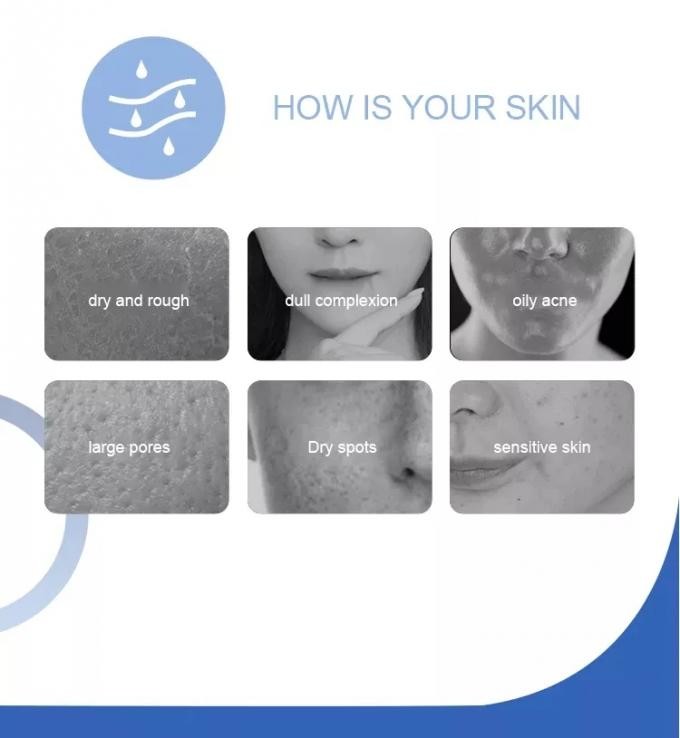14 In 1 Peeling Hydro Microdermabrasion, Oxygen Jet Aqua Care, Deep Cleansing And Moisturizing Skin, Removes wrinkles