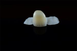 Quality Customized Dental Resin-bonded Maryland bridge wholesale