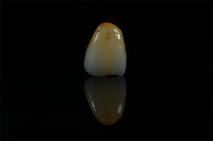 Quality Precise White Porcelain Layered Zirconia Stain With Emax OEM wholesale