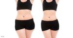 Body Control Weight Loss Cryolipolysis Slimming Machine Continuous Contact