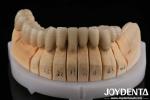 Gold Alloy PFM Porcelain Fused to Metal Dental Compatible With Porcelain