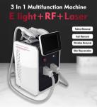 DPL 2022 Hot Selling picosecond laser portatil Nd YAG Laser Tattoo Removal 3 In