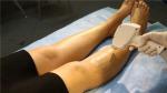 Professional Permanent 808nm Diode Laser Hair Removal Machine For Beauty Clinic