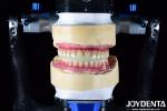 Lightweight Dental Titanium Malong Hybrid Bridge Comfortable For Dental