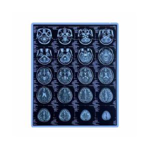 Quality CE Printable Blue Medical X Ray Film 11x14 Inch Pet Inkjet Film wholesale