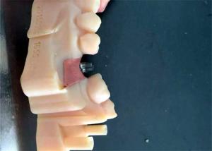Quality CAD / CAM PFM Dental Crowns Bridge Resin Material Good Biocompatibility Stability wholesale