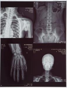 Quality Silver Halide Blue Inkjet Film For Medical Imaging wholesale