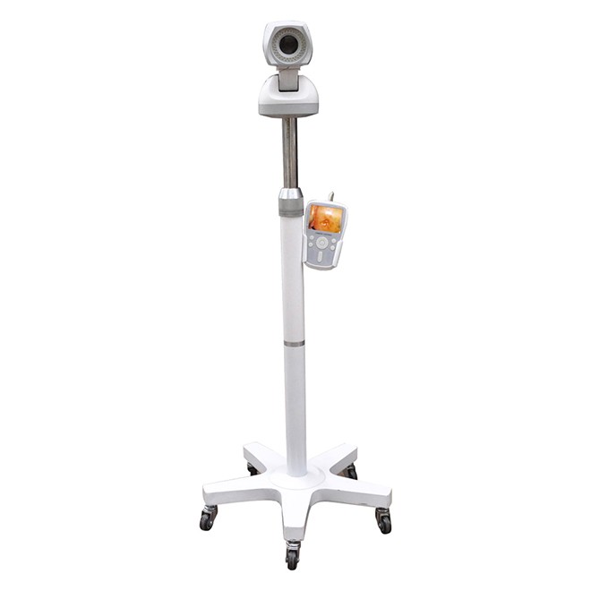 Professional Video Colposcope Endoscope Gynaecology Colposcope CE03