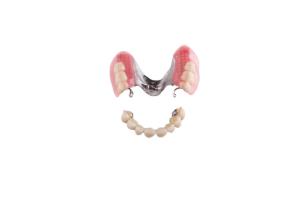 Quality FILLED REMOVABLE DENTURES CROWN INVISIBLE TEMPORARY OVERDENTURES DENTURE PROCESSIN wholesale