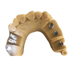 Quality Digital Biocompatibility PFM Dental Crown 3D Printing Temporary Crowns wholesale