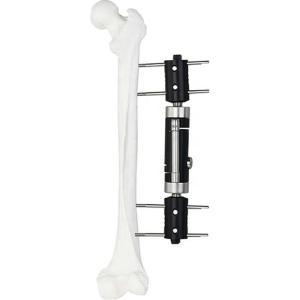 Quality Orthopedic Medical Implant Straight Type External Fixator Ex Fix Device wholesale