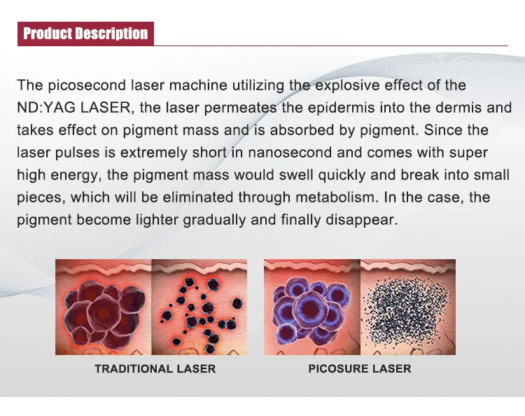Tattoo/Pigment Removal Nd Yag Laser Machine Picosecond Laser Skin Whitening Wrinkle Removal As60