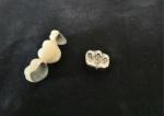 OEM Polishing Porcelain Dental Crown High Biological Intermiscibility