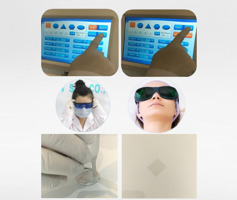 CO2 Fractional Laser Device with Touchscreen Interface for Advanced Skin Therapy Wrinkle Removal and Lifting