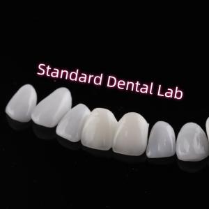 Quality Abrasion Resistant Emax Zirconia Laminate Veneers Incisal Translucency wholesale