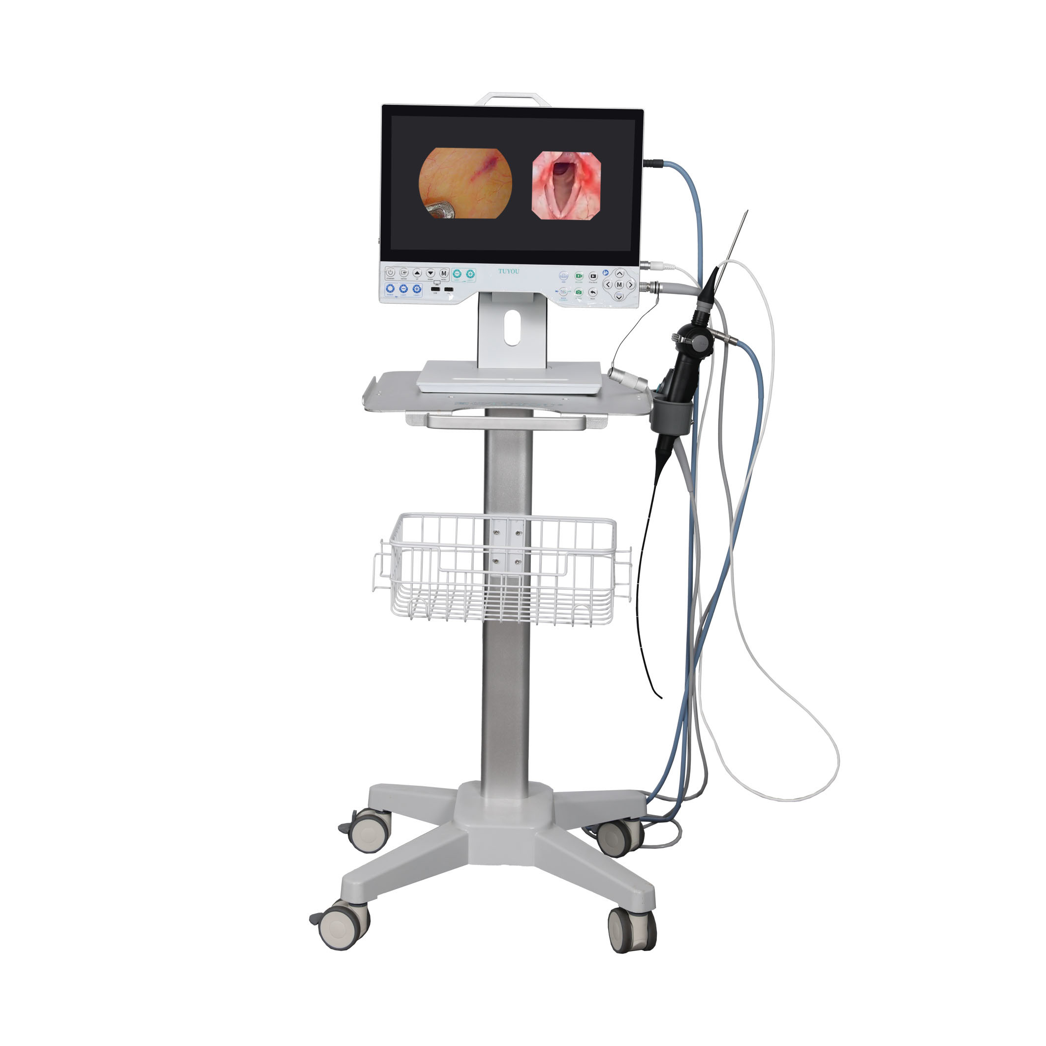 All in One Rigid and Flexible Endoscopy Camera TU-15LSD1E HDMI/SDI/CVBS/VGA/DVI Output Interface and Built-in Light Source
