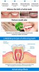TEETH WHITENING ESSENCE