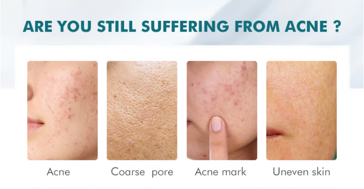 BHA serum